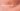 Close-up of white, threadlike pinworms in human stool, realistic, medical illustration, detailed view, slightly blurred background, clinical lighting.