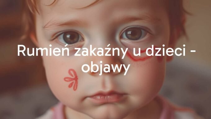 A child with red butterfly-shaped rash on the face, looking slightly unwell, soft lighting, realistic style.