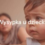 Child with a mild skin rash, concerned mother in the background, soft lighting, realistic.