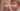Child with a mild skin rash, concerned mother in the background, soft lighting, realistic.