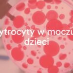 A microscope view of red blood cells in a urine sample, medical setting, clean and professional lighting, realistic.