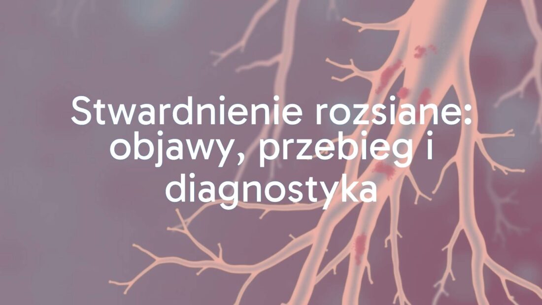 Abstract representation of nerve fibers with damaged myelin sheaths, blue and white color scheme, medical illustration style.